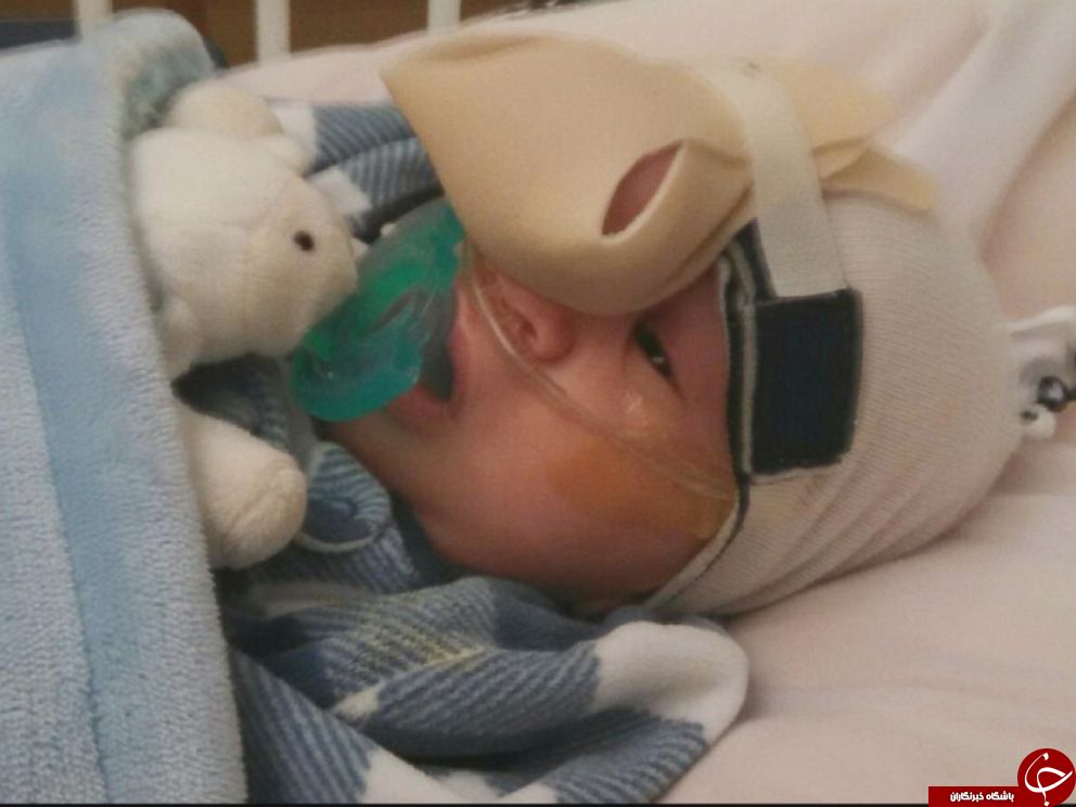 بیماری عجیب یک کودک پزشکان را به چالش کشید+تصاویر