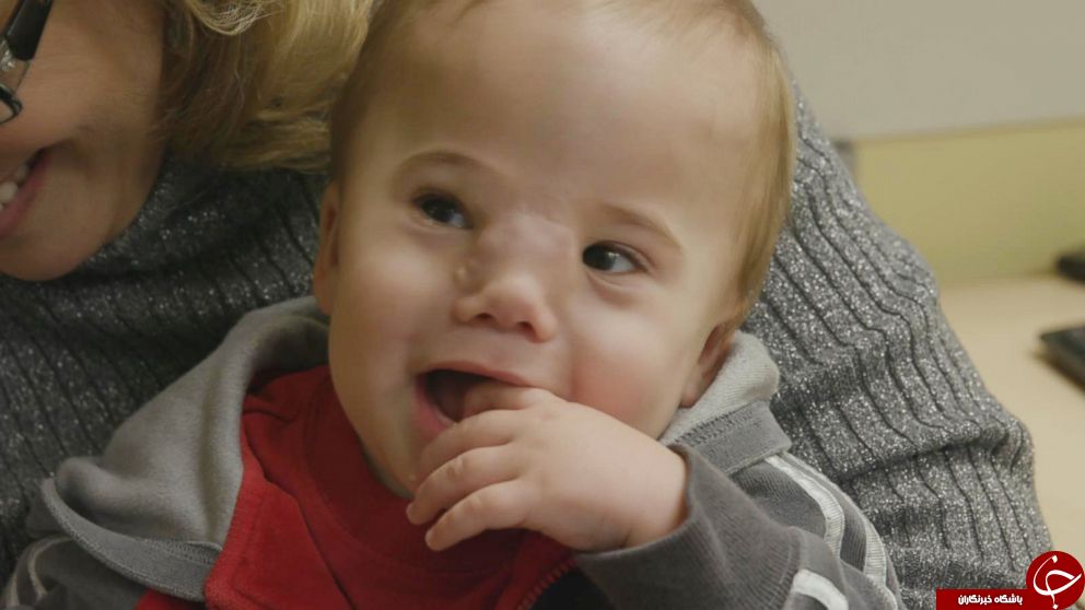 بیماری عجیب یک کودک پزشکان را به چالش کشید+تصاویر