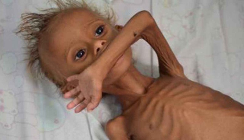 باتلاق یمن؛ بن بست رویاهای عبری عربی/ آتشی که دلارهای سعودی را سوزاند