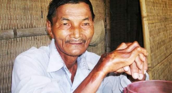 معرفی عجیب و غریب ترین انسان های جهان (تصاویر) معرفی عجیب و غریب ترین انسان های جهان (تصاویر)