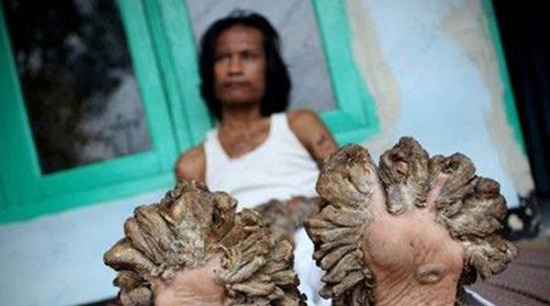 این بیماری های ترسناک تخیلی نیستند!