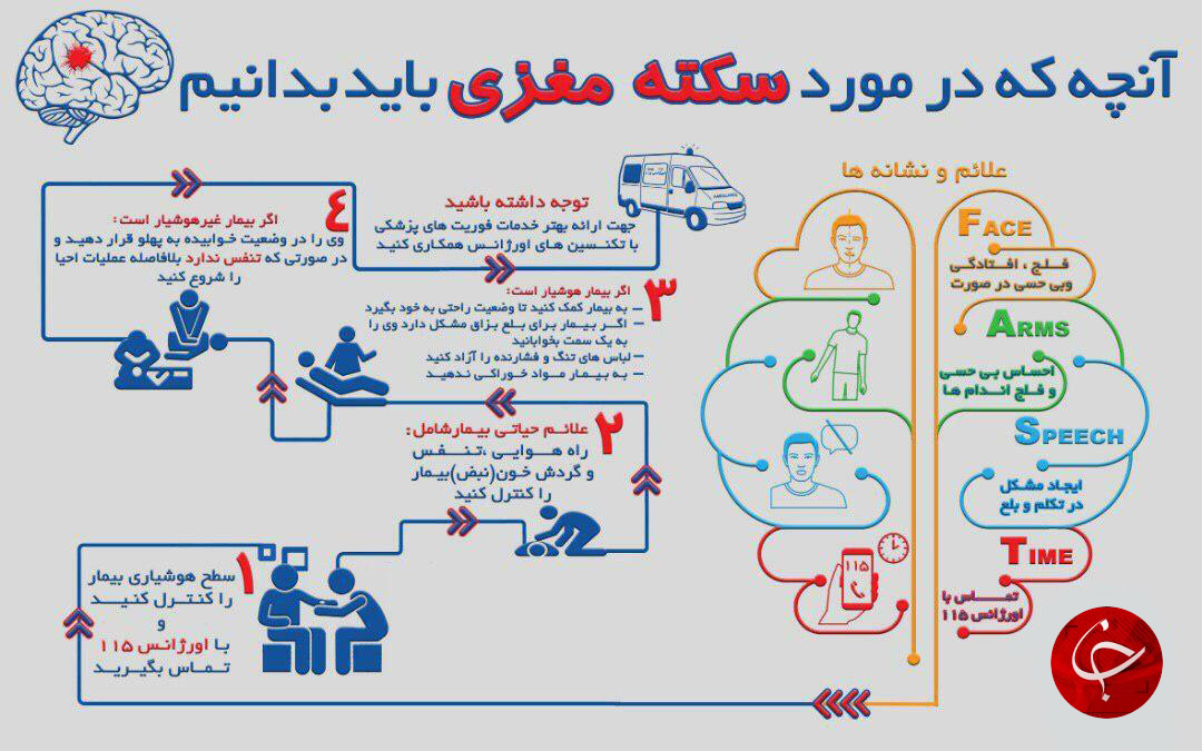 آنچه که در مورد سکته مغزی باید بدانیم