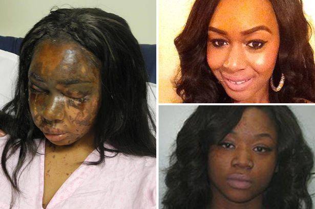 بحران اسیدپاشی و چاقوکشی در لندن/ زیر پوست پایتخت بریتانیا چه می‌گذرد؟ +عکس