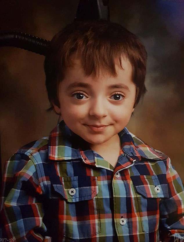 کودکی که دچار ۵۰۰ بار شکستگی اعضای بدن شده است + تصاویر