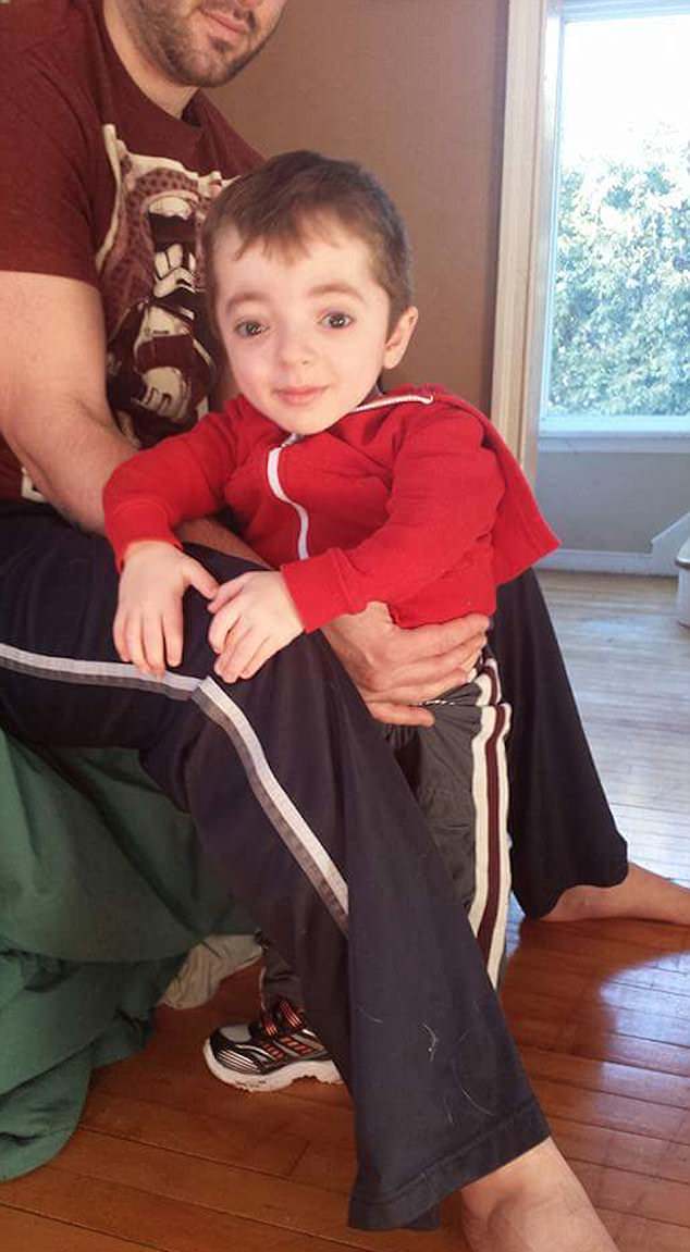 کودکی که دچار ۵۰۰ بار شکستگی اعضای بدن شده است + تصاویر