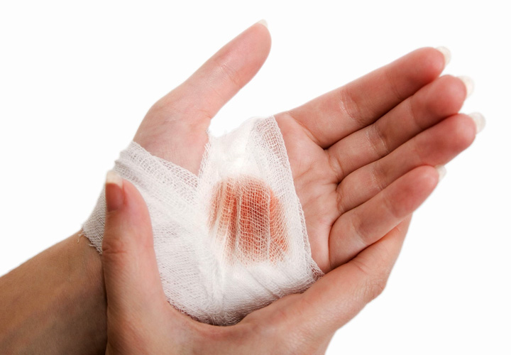 دیر التیام یافتن زخم‌ها