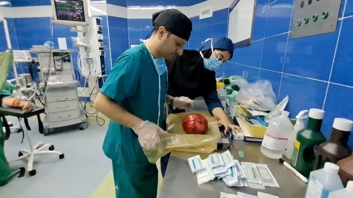 خارج‌کردن تومور ۱۱ کیلویی از شکم بیمار