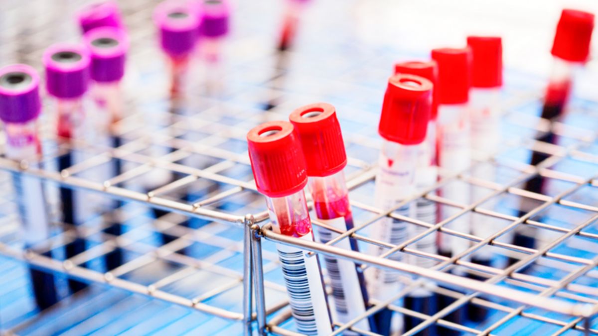 دانشمندان موفق به حذف ویروس HIV از سلول های آلوده شده‌اند