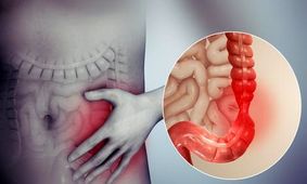 راهکاری برای درمان سندورم روده تحریک پذیر/ ویدئو