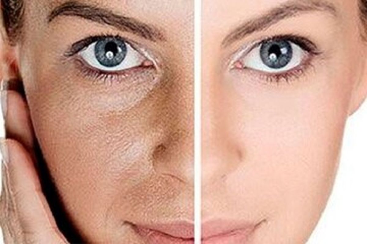این میوه‌ها برای سلامت پوست معجزه می‌کنند