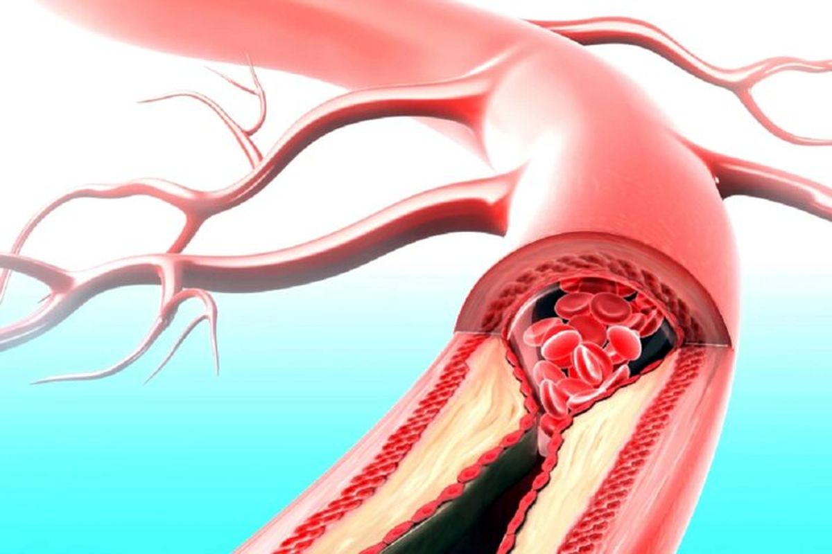 دارویی که همزمان با بیماری قلبی و دیابت مقابله می‌کند

