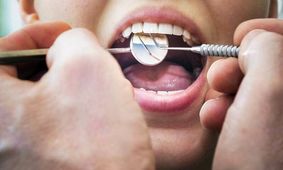 اگر سن تان بالای ۴۰ سال است مراقب این بیماری دهانی باشید