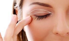 روش های تخلیه چربی پشت پلک