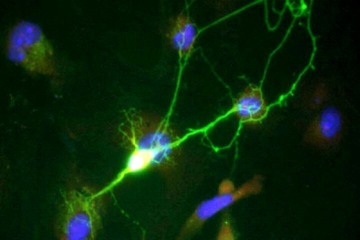 جلوگیری از مرگ نورون‌ها در آلزایمر با یک داروی رایج

