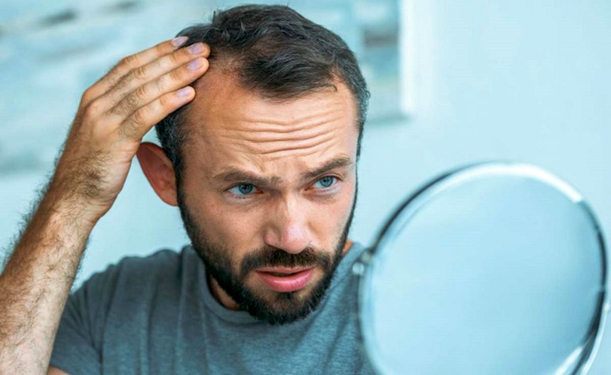 درمان‌های طبیعی برای مقابله با نازکی مو