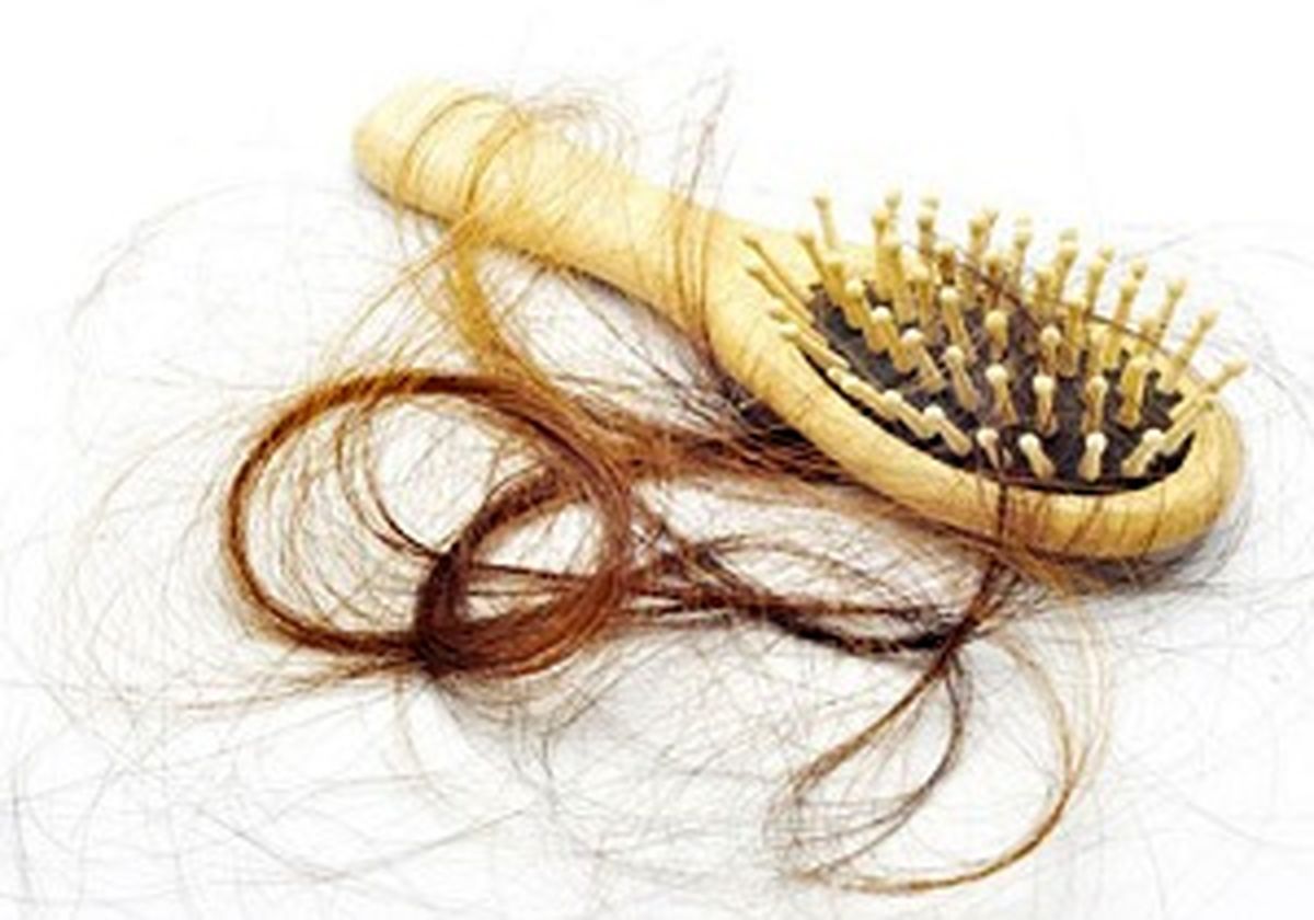 چگونه از ریزش مو جلوگیری کنیم