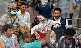 ۲۳۳ هزار تن در جنگ یمن کشته شده اند