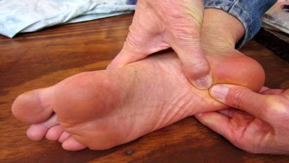 علت و علائم خار پاشنه از دیدگاه طب سنتی