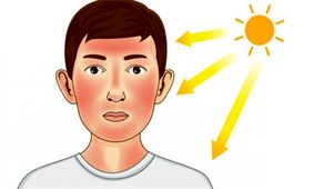 کار‌هایی که پس از ابتلا به آفتاب سوختگی نباید انجام داد