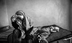 راهکارهایی برای تهیه گزارش از سوء تغذیه