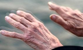 ۳ دلیل اصلی ابتلا به پارکینسون را بشناسیم
