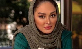 تغییر چهره الهام حمیدی بازیگر سریال آتش و شبنم در ۴۸ سالگی