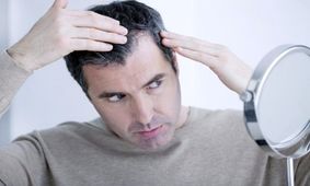 وقتی ژنتیک نقشی در ریزش مو ندارد
