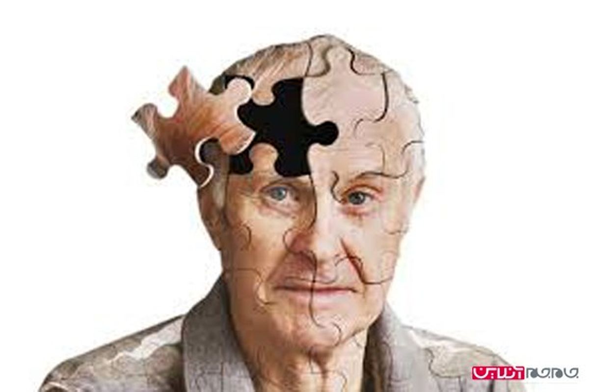 ایروبیک سدی در مقابل آلزایمر