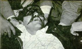 شنبه ۲۱ بهمن ۵۷؛ آمار رسمی کشته‌شدگان و مجروحان تهران در یک روز اعتراضات: ۱۶۳ کشته و ۶۲۲ مجروح به جز مجروحان بیمارستان نیروی هوایی