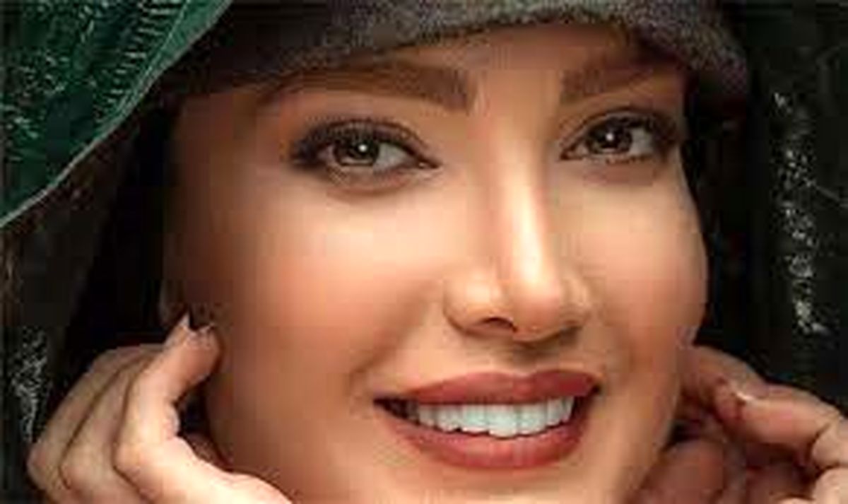 از عاشقانه همسر متین تا کاشت موی احسان کرمی
