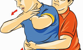 اگر شخصی چیزی در گلویش گیر کرد چه کارهایی را انجام دهیم/ ویدئو
