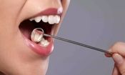 نیشکر، سپری جدید برای محافظت از دندان ها