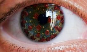 علائم کرونای چشمی را جدی بگیرید